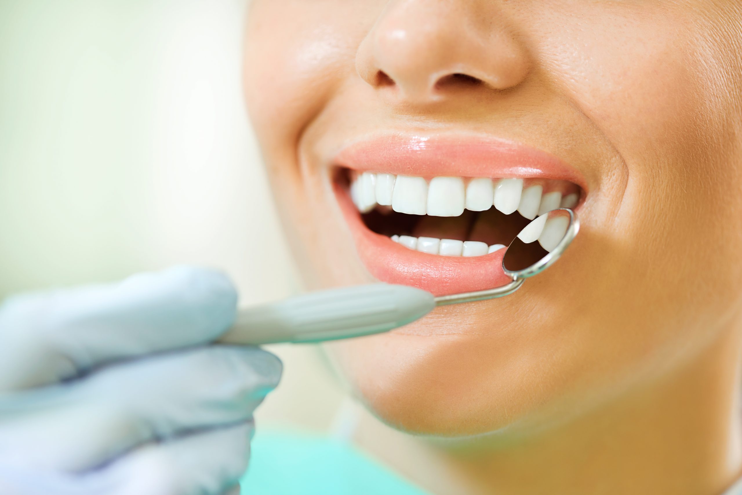 Does Teeth Whitening Work on Crowns and Veneers?